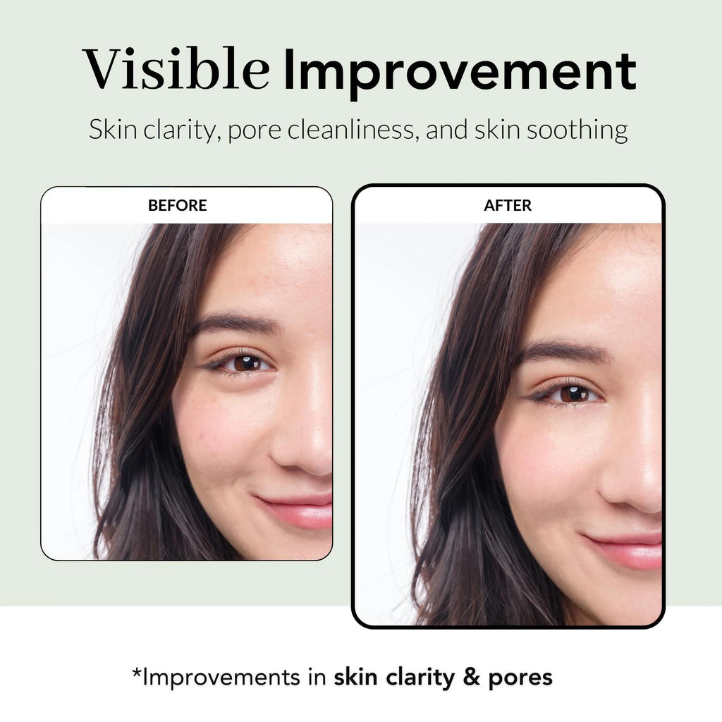 Tea Tree Wrapping Mask Skin Soothing Care Acne Prone Skin 2.4 Oz Teatree & 6 Tropical Fruit Extracts Calming Peel off Mask Korean Skincare for Face